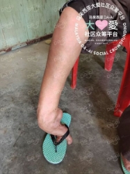 Picture of (CAMPAIGN CLOSED) BENEFICIARY PROFILE 586 WAN YOW