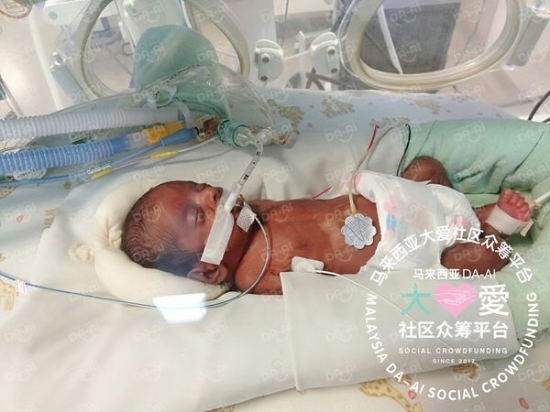 Picture of (CAMPAIGN CLOSED) BENEFICIARY PROFILE 597 JAYDEN SAMUEL A/L KUMARESAN