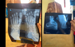 Picture of (CAMPAIGN CLOSED) BENEFICIARY PROFILE 850 JUNAIDI BIN IYOP