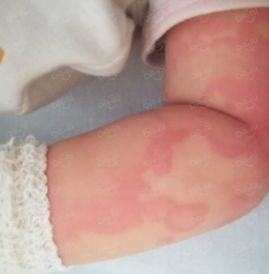 Picture of (CAMPAIGN CLOSED) BENEFICIARY PROFILE 972 HOH KAA CHUN