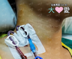 Picture of (CAMPAIGN CLOSED) BENEFICIARY PROFILE 992 WILLIAM HONG HUEY LIAN