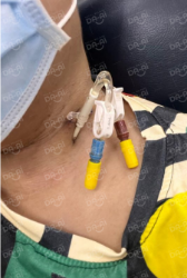 Picture of BENEFICIARY PROFILE 1622 WONG HUI THING