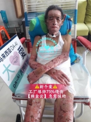 Picture of (CAMPAIGN CLOSED) BENEFICIARY PROFILE 540 LAI JIN YUN