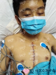 Picture of (CAMPAIGN CLOSED) BENEFICIARY PROFILE 1730 KHOO-YEAK-XUAN