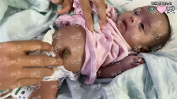 Picture of (CAMPAIGN CLOSED) BENEFICIARY PROFILE 1736 TIARA NUR AFIA