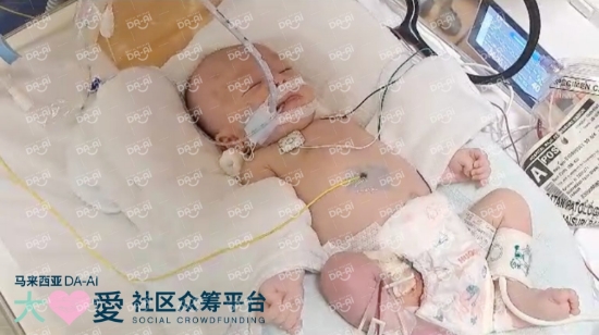 Picture of (CAMPAIGN CLOSED) BENEFICIARY PROFILE 1762 MUHAMMAD FATH DHANI