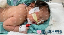 Picture of (CAMPAIGN CLOSED) BENEFICIARY PROFILE 1767 BABY OF MARIANI NURDINSYAM