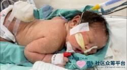 Picture of (CAMPAIGN CLOSED) BENEFICIARY PROFILE 1767 BABY OF MARIANI NURDINSYAM