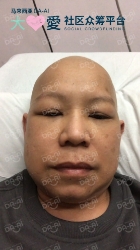 Picture of (CAMPAIGN CLOSED) BENEFICIARY PROFILE 1832 CHEW HUI YEW