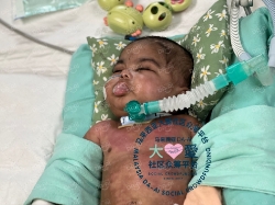 Picture of (CAMPAIGN CLOSED) BENEFICIARY PROFILE1840 DHAREASHAN MUTHALIYAR A/L SUNTHARANATHAN