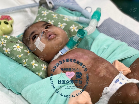 Picture of (CAMPAIGN CLOSED) BENEFICIARY PROFILE1840 DHAREASHAN MUTHALIYAR A/L SUNTHARANATHAN