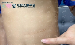 Picture of (CAMPAIGN CLOSED) BENEFICIARY PROFILE 1841 HO LI YANG