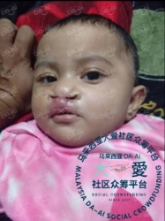 Picture of (CAMPAIGN CLOSED) BENEFICIARY PROFILE 1842 NUR RABIHTUL ADAWIYAH REZUADIN