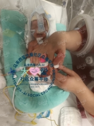 Picture of (CAMPAIGN CLOSED) BENEFICIARY PROFILE 1846 BABY WONG SANG WAH