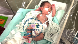 Picture of (CAMPAIGN CLOSED) BENEFICIARY PROFILE 1846 BABY WONG SANG WAH