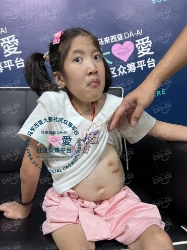 Picture of (CAMPAIGN CLOSED) BENEFICIARY PROFILE 1850 TAN MAY YAN