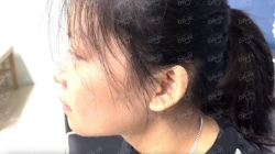 Picture of (CAMPAIGN CLOSED) BENEFICIARY PROFILE 1788 CHAN CHU TING