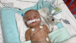 Picture of (CAMPAIGN CLOSED) BENEFICIARY PROFILE 1915 IMAAN HUSSAIN NABI HUSSAIN