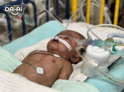 Picture of (CAMPAIGN CLOSED) BENEFICIARY PROFILE 1915 IMAAN HUSSAIN NABI HUSSAIN