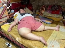 Picture of (CAMPAIGN CLOSED) BENEFICIARY PROFILE 1928 WONG YUEN FUN