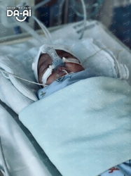 Picture of (CAMPAIGN CLOSED) BENEFICIARY PROFILE 1936 SHAFIRA AZZAHRA