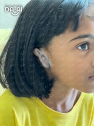 Picture of (CAMPAIGN CLOSED) BENEFICIARY PROFILE 1949 NISHAA A/P SUHANANTHAH