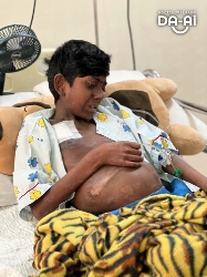 Picture of (CAMPAIGN CLOSED) BENEFICIARY PROFILE 1982 THESHIVIN A/L RAMESH