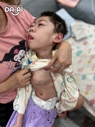 Picture of (CAMPAIGN CLOSED) BENEFICIARY PROFILE 1998 CHOW KAI QI