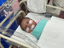 Picture of (CAMPAIGN CLOSED) BENEFICIARY PROFILE2040 BABY OF WAHYU PUTRI NINGSIH