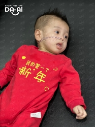 Picture of (CAMPAIGN CLOSED) BENEFICIARY PROFILE 2056 ANDY KHERN MING KAI