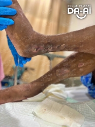 Picture of (CAMPAIGN CLOSED) BENEFICIARY PROFILE 2087 SASI KUMAR A/L VATHU MALAI