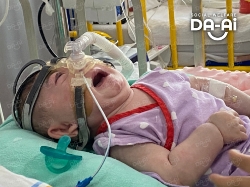 Picture of (CAMPAIGN CLOSED) BENEFICIARY PROFILE 2103 BI YO NA LEME