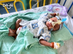 Picture of (CAMPAIGN CLOSED) BENEFICIARY PROFILE 2123 MUHAMAD ARMAN MUHAMAD SALIM