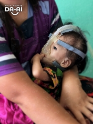 Picture of (CAMPAIGN CLOSED) BENEFICIARY PROFILE 2142 PUTERI CHARISSA BINTI ADDIE WIJAYA