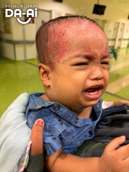 Picture of (CAMPAIGN CLOSED) BENEFICIARY PROFILE 2156 MUHAMMAD NAIM PAHLEVI ANAS