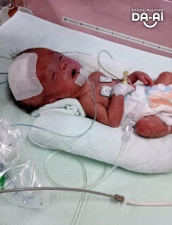 Picture of (CAMPAIGN CLOSED) BENEFICIARY PROFILE 2173 ADELYNN YIP JIA XUAN