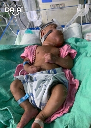 Picture of (CAMPAIGN CLOSED) BENEFICIARY PROFILE 2182 POYAKSHAN RAU A/L MOHANRAU