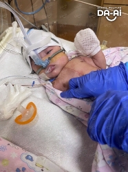 Picture of (CAMPAIGN CLOSED) BENEFICIARY PROFILE 2188 NUR AURA SYAFIA BINTI MUHAMMAD SHAHRUL ARIF