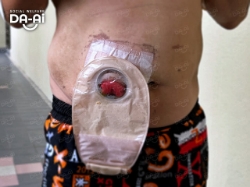 Picture of (CAMPAIGN CLOSED) BENEFICIARY PROFILE 2210 CHOI YEW LOY