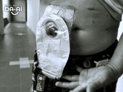 Picture of (CAMPAIGN CLOSED) BENEFICIARY PROFILE 2210 CHOI YEW LOY