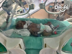 Picture of FUNDRAISING CASE 2215 RENISHKA SREE