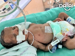 Picture of FUNDRAISING CASE 2215 RENISHKA SREE